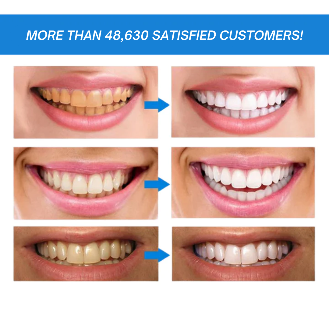 1+1 Free - CleanOral™ - Teeth whitening pen | Instant teeth whitening!