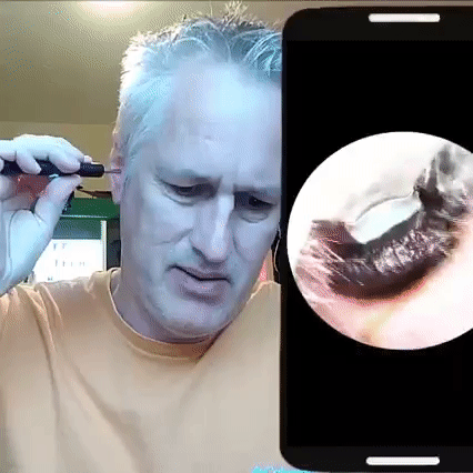 ClearEar™ - Earwax Remover with Camera