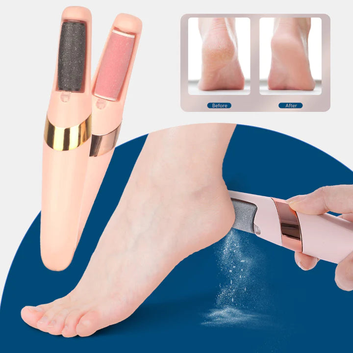PediPerfection™ Remove calluses effortlessly!